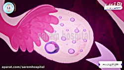 لقاح مصنوعی و آزمایشگاهی و IVF