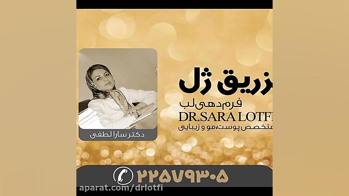 تزریق ژل دکتر سار ا لطفی