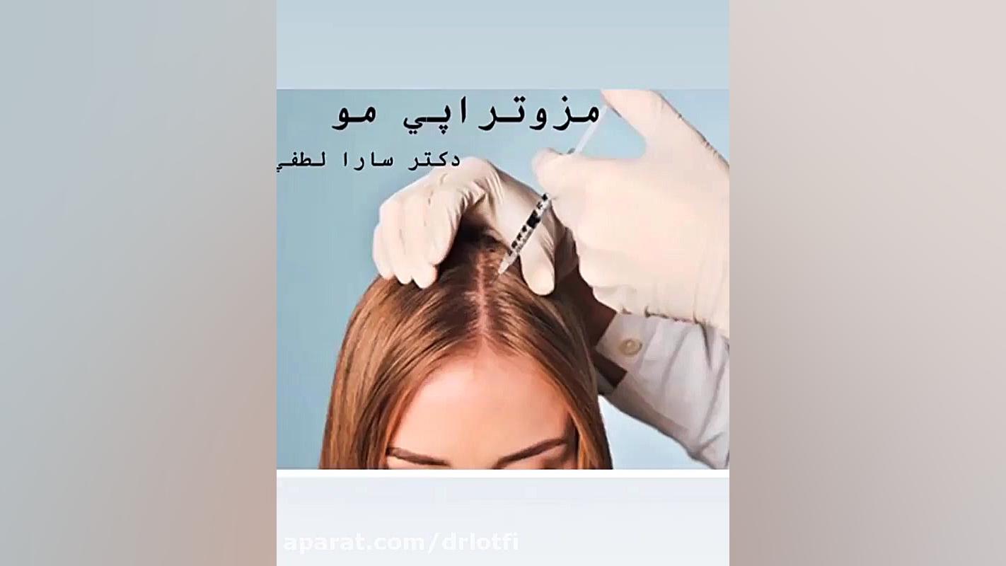 مزوتراپی دکتر سار ا لطفی
