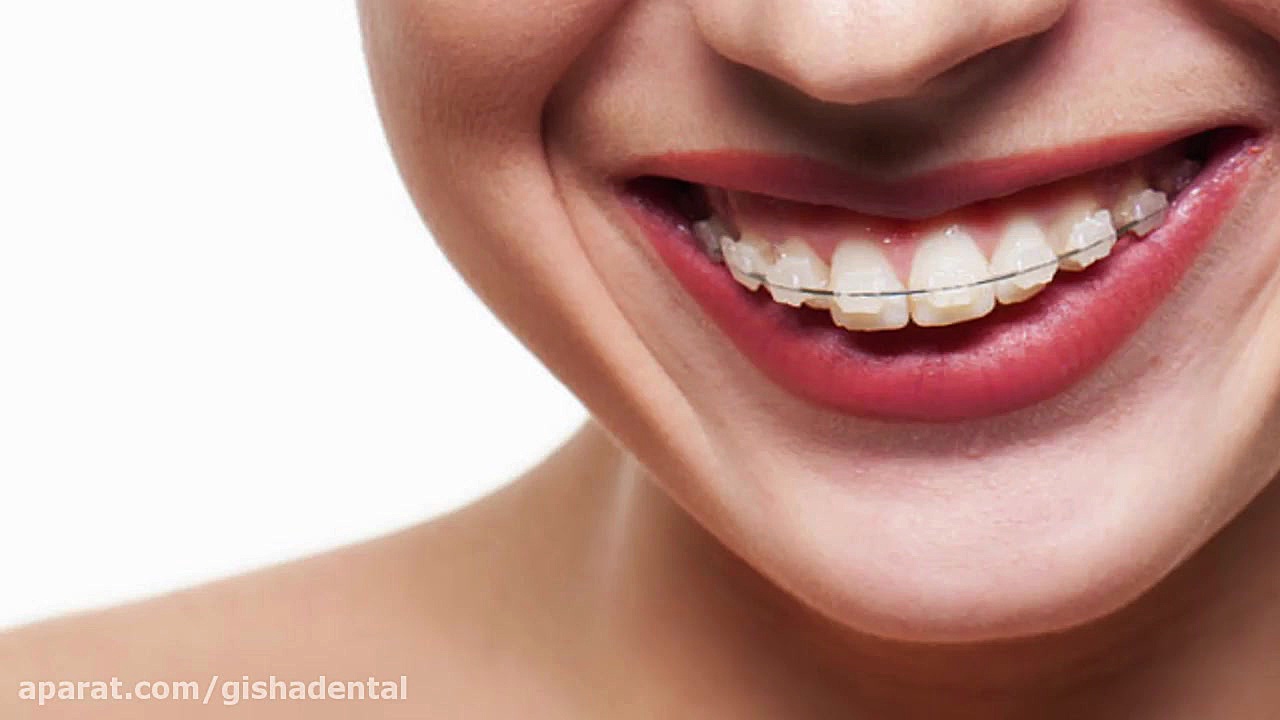 ارتوپدی فک توسط متخصص ارتودنسی کلینیک دندانپزشکی دکتر عزیز گشاده رو