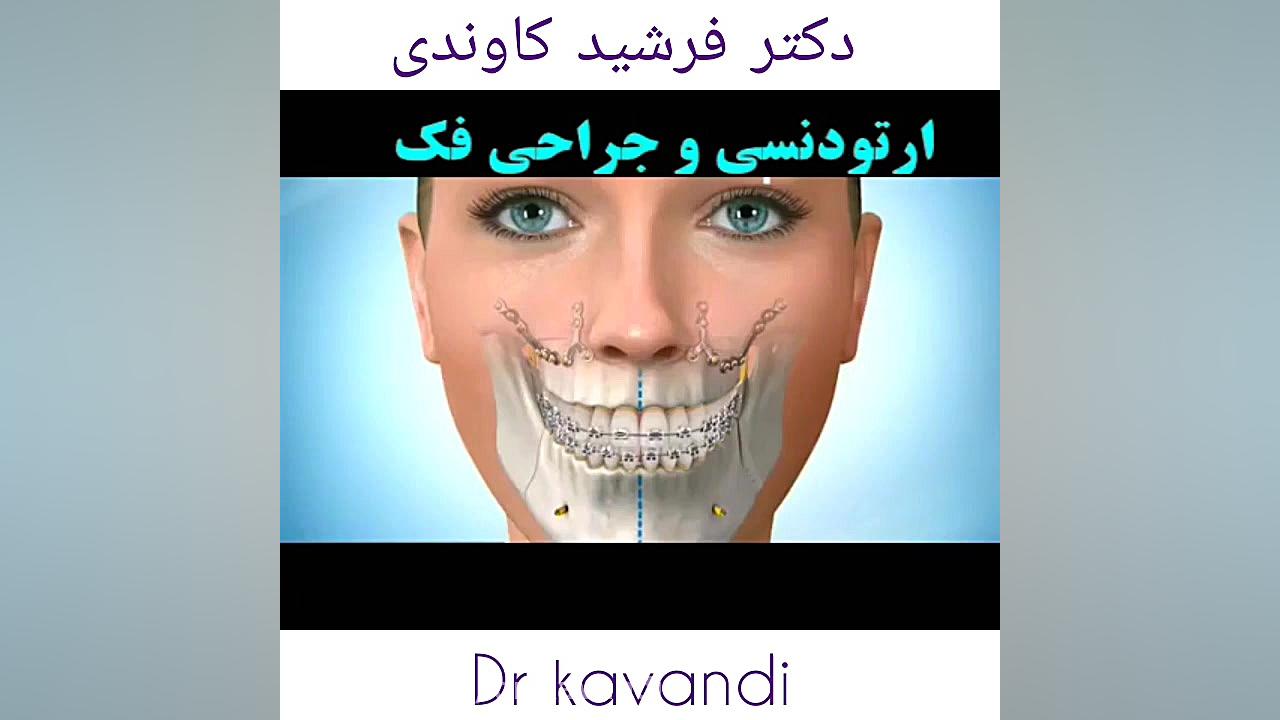 ارتودنسی و جراحی فک آزمون NanoString