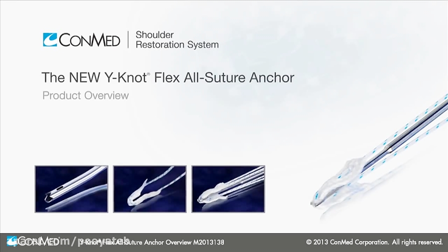 Benefits of the YKnot® Flex AllSuture Anchor ConMed Overview Video
