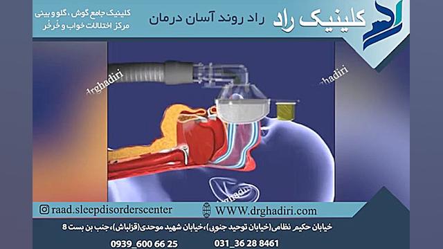درمان مشکلات تنفسی CPAP دکتر مهدی قدیری