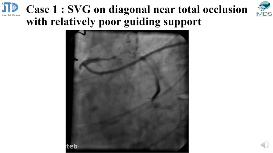 clinical application of guidion