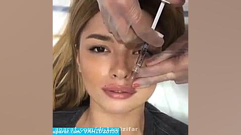 تزریق ژل به لب دکتر بنفشه تمیزی فر