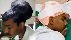 دیدنی ها : بزرگترین تومور مغزی...