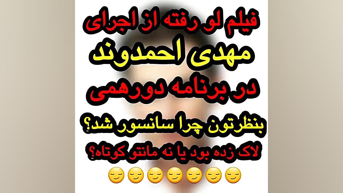 مهدی احمدوند در دور همی لورفته لیزر صورت