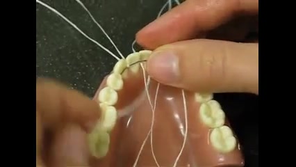 نگهدارنده ارتودنسی دکتر سهیل سالاری