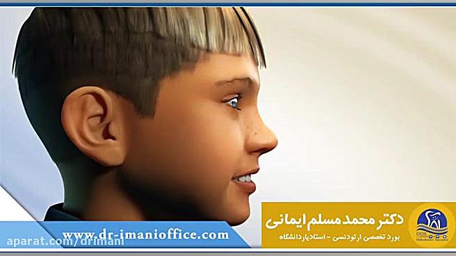 ناهنجاری فک کلاس ۲ و ۳ دکتر محمد مسلم ایمانی - متخصص ارتودنسی در کرمانشاه