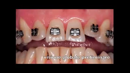 بهداشت در ارتودنسی دکتر سهیل سالاری