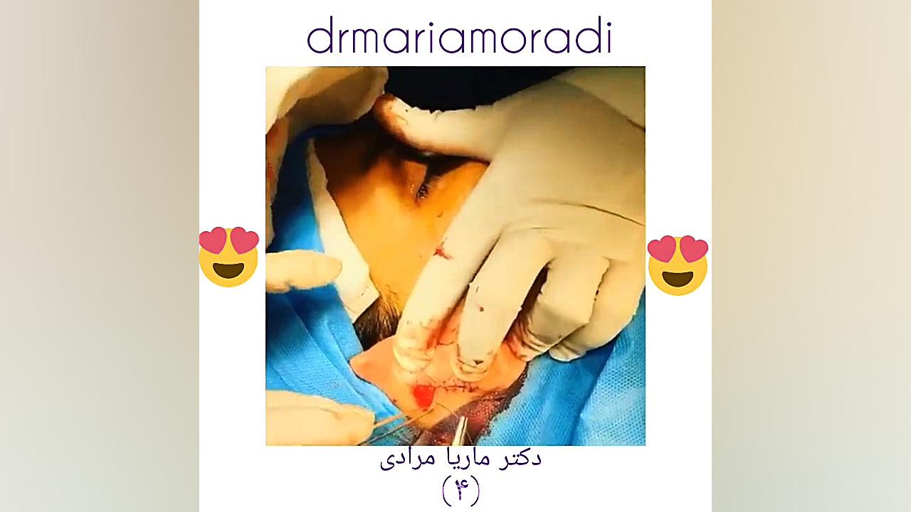 جراحی زیبایی گوش ترمیم سوختگی