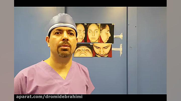 جراحی بینی استخوانی قوز دار توسط دکتر امید ابراهیمی دکتر امید ابراهیمی