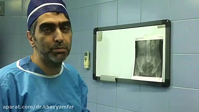 خارج کردن دبی جی بصورت سرپائی جراحی پف زیر چشم