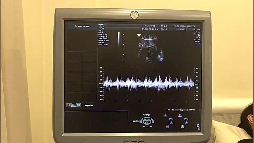 سونوگرافی جنین - توضیح بیوفیزیکال سونوگرافی نیلو دکتر فاطمه مهتاب قربانی
