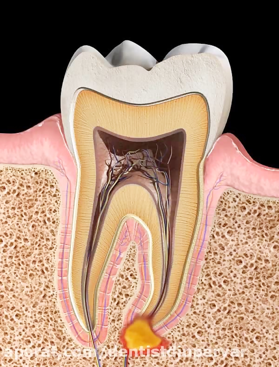 зубной нерв строение зуба фото