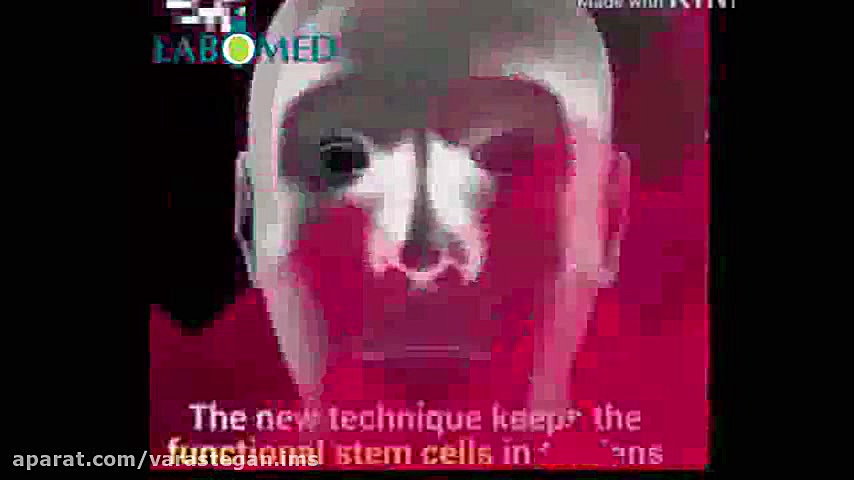 ساخت عدسی هایی از جنس سلول بنیادی جهت درمان نابینایی Southern Blot
