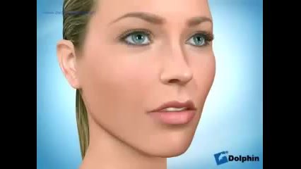 نحوه چسباندن دستگاه های ارتودنسی به دندان ها دکتر سهیل سالاری