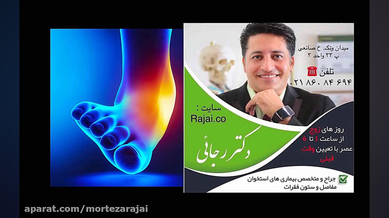پیچ خوردگی مچ پا دکتر رجایی جراح و متخصص ارتوپدی بلیچینگ دندان