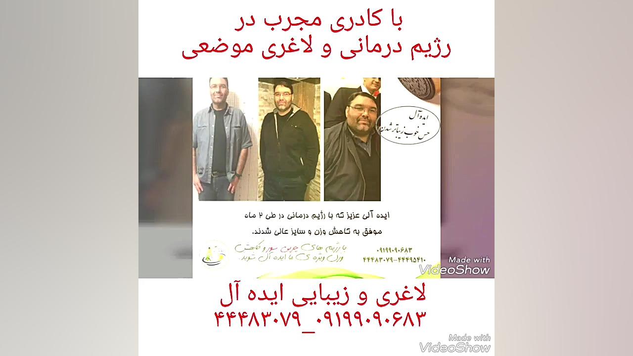 بهترین کلینیک لاغری در غرب تهران بلیچینگ دندان