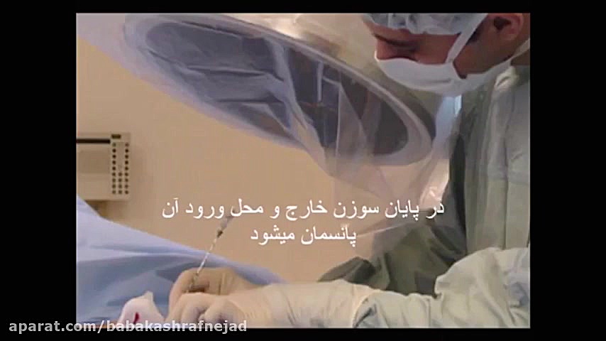 درمان دیسك ستون فقرات با لیزر دکتر بابک اشرف نژاد