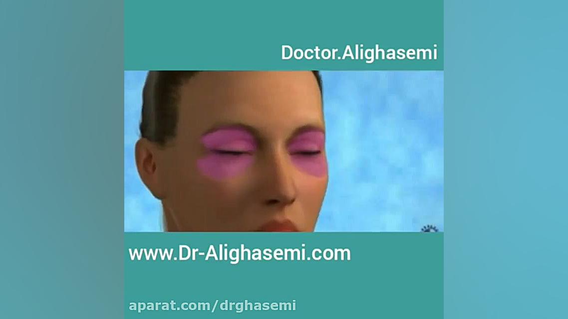 جراحی زیبایی پلک 1 دکتر علی قاسمی(پوست ، مو ، زیبایی )