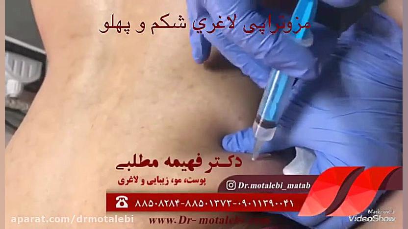 مزوتراپی لاغری راوالیزوماب
