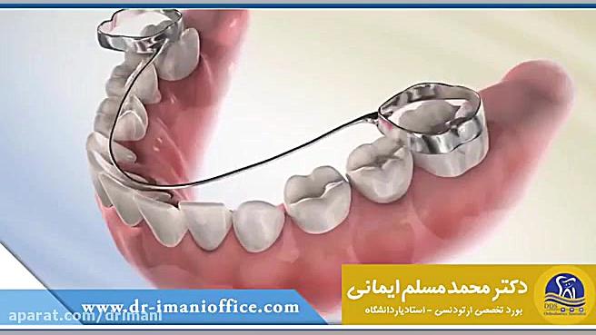 استفاده از فضا نگهدارنده در دندان کودکان دکتر محمد مسلم ایمانی - متخصص ارتودنسی در کرمانشاه