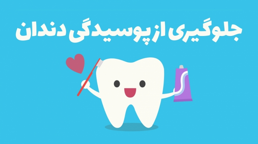 ۵ راهکار برای جلوگیری از پوسیدگی دندان ها عمل زیبایی