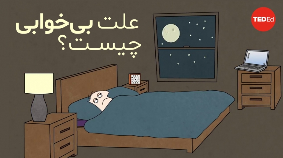 علت بی خوابی چیست؟ کامپوزیت ونیر