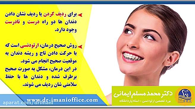 روش های ردیف کردن دندان ها دکتر محمد مسلم ایمانی - متخصص ارتودنسی در کرمانشاه