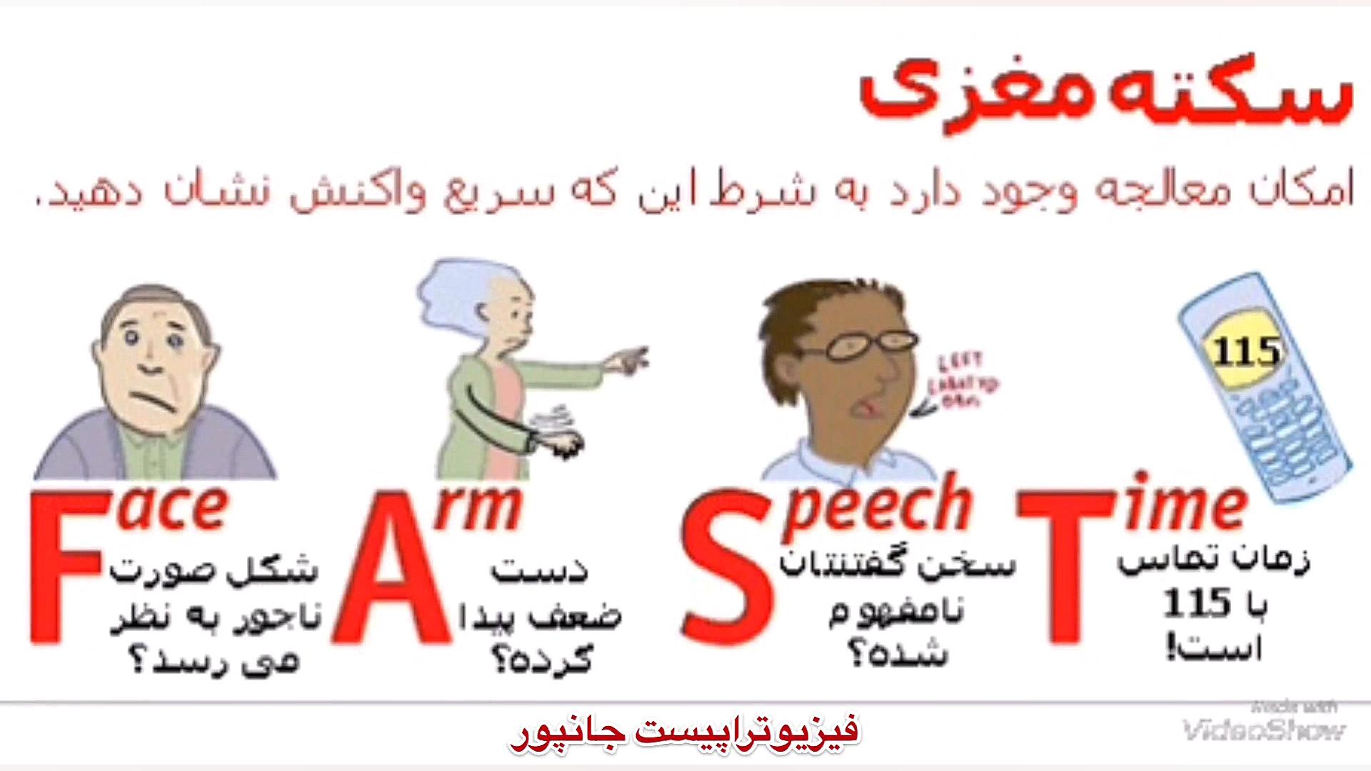 علامت سکته مغزی! 09122655648 مطب پزشک متخصص طب فیزیکی،توانبخشی و فیزیوتراپی بیانسه