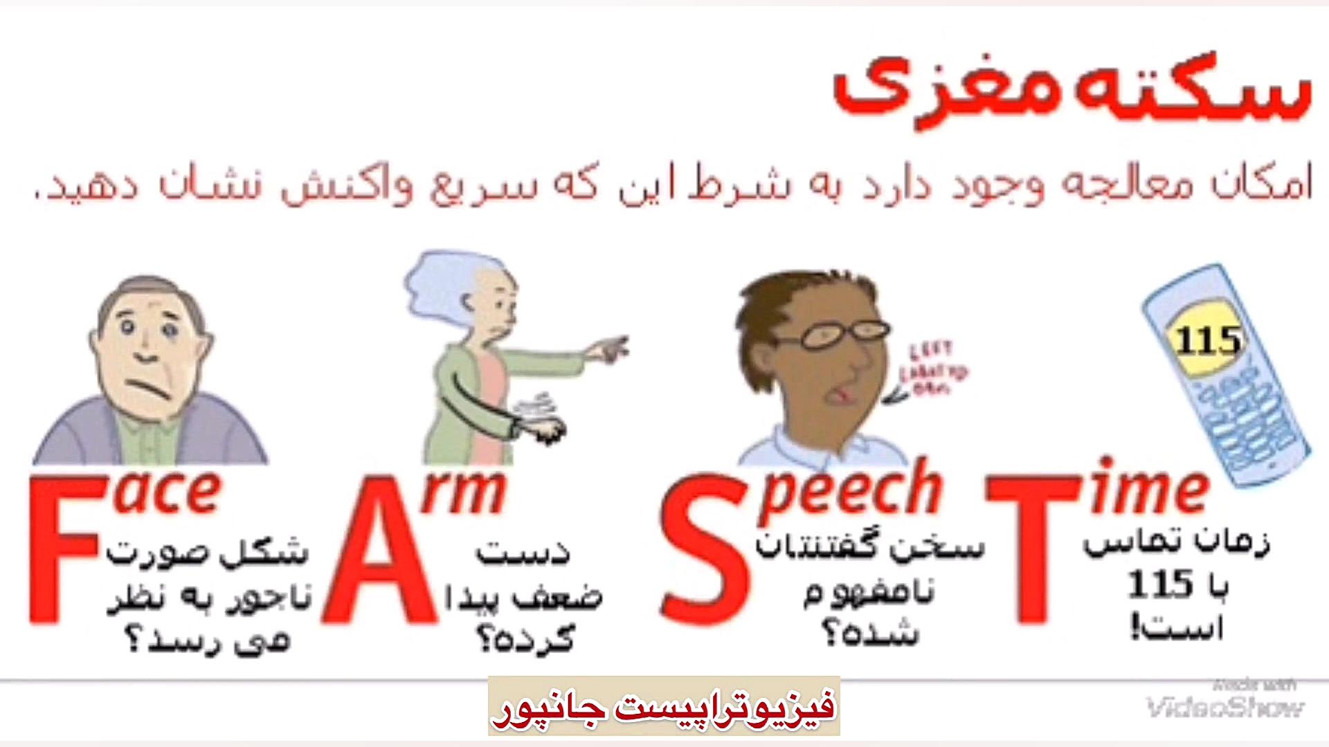نشانه های بسیار مهم سکته مغزی09122655648 مرکز فیزیوتراپی.طب فیزیکی و توانبخشی اصلاح طرح لبخند