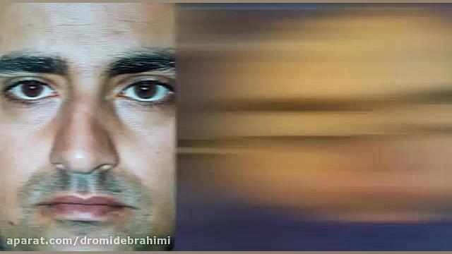 جراحی بینی گوشتی توسط دکتر امید ابراهیمی بهترین جراح بینی دکتر امید ابراهیمی