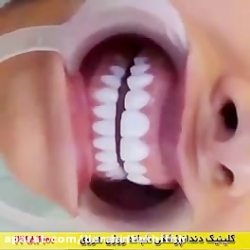 دانویاد"زمان رویش دندان های شی...