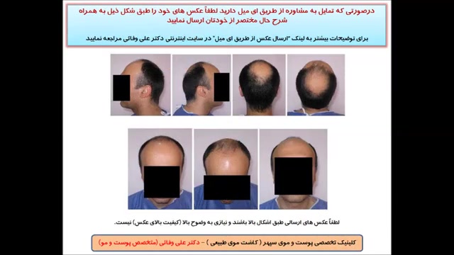 عکس های بیماران دکتر علی وفائی - بخش هفتم دکتر علی وفائی - متخصص پوست و مو