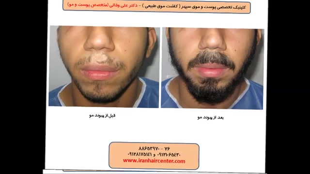 عکس های بیماران دکتر علی وفائی - بخش پنجم دکتر علی وفائی - متخصص پوست و مو
