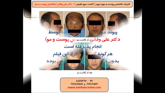 عکس های بیماران دکتر علی وفائی - بخش سوم دکتر علی وفائی - متخصص پوست و مو