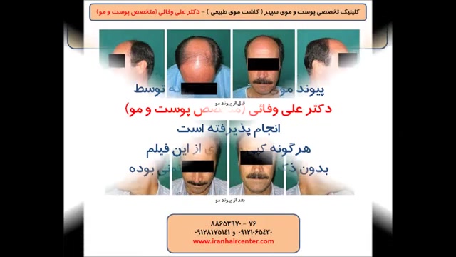 عکس های بیماران دکتر علی وفائی - بخش اول دکتر علی وفائی - متخصص پوست و مو