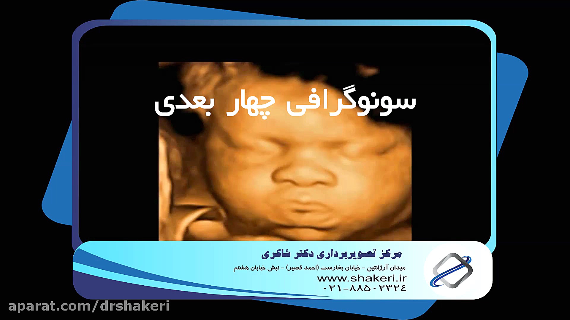 تفاوت سونوگرافی 2D-3D-4D / مرکز تصویربرداری دکتر شاکری جوانسازی پوست