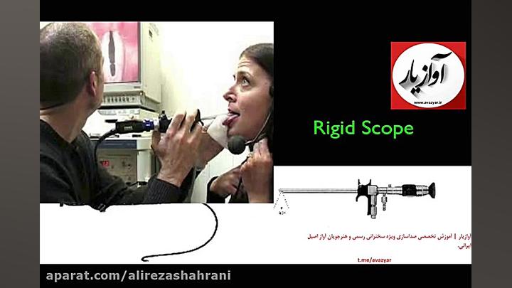 عکس از حنجره | لارنگوسکوپی | استروبوسکوپی کاشت مو