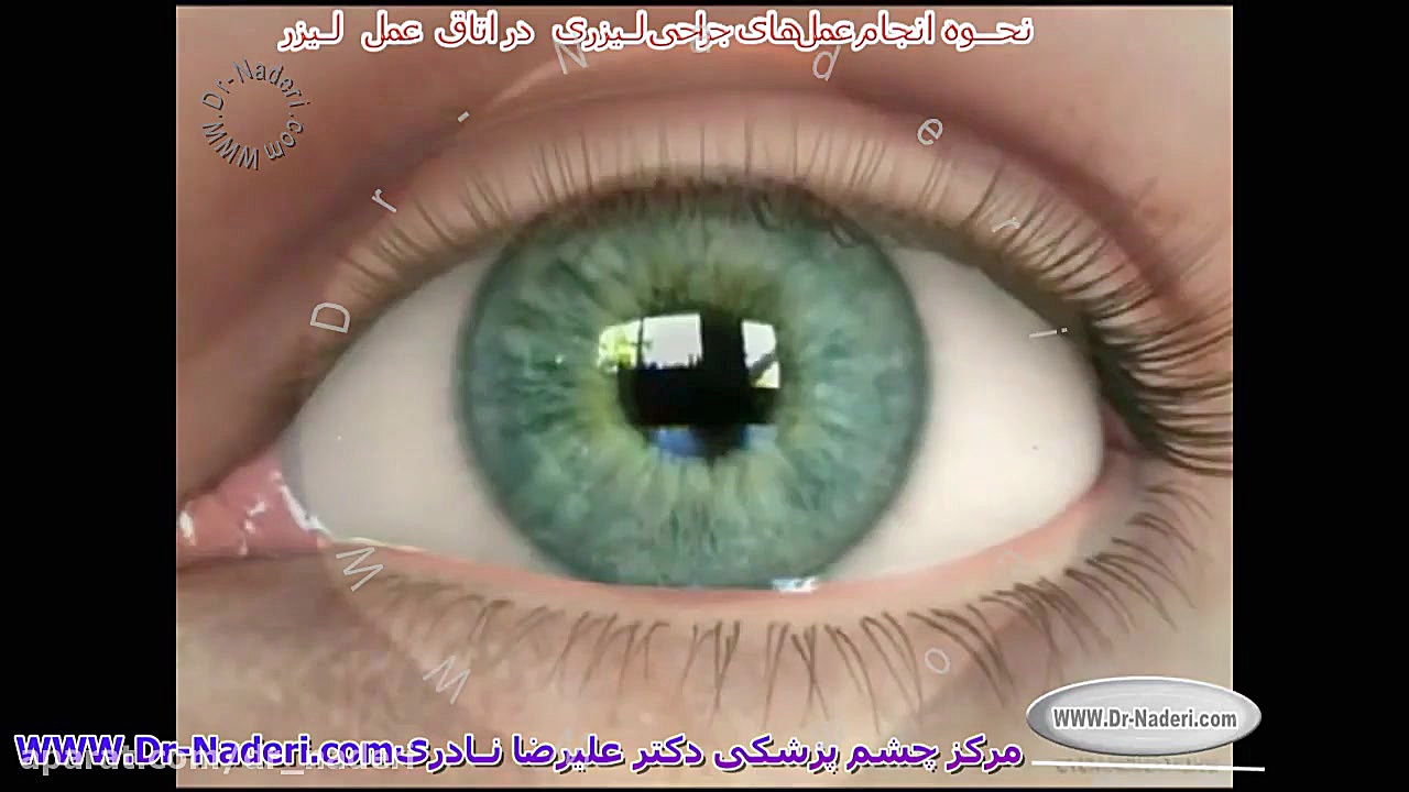 تکنیک انجام جراحی عیوب انکسار- مرکز چشم پزشکی دکتر علیرضا نادری مرکز چشم پزشکی دکتر علیرضا نادری www.dr-naderi.com