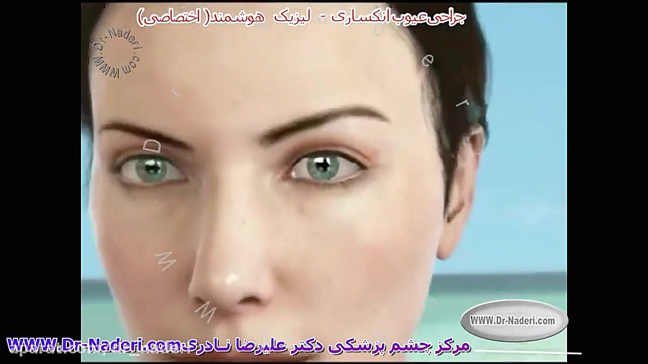 لیزیک هوشمند - مرکز چشم پزشکی دکتر علیرضا نادری مرکز چشم پزشکی دکتر علیرضا نادری www.dr-naderi.com