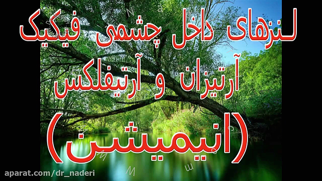کارگذاری لنز آرتیزان و آرتیفلکس-مرکز چشم پزشکی دکتر علیرضا نادری مرکز چشم پزشکی دکتر علیرضا نادری www.dr-naderi.com