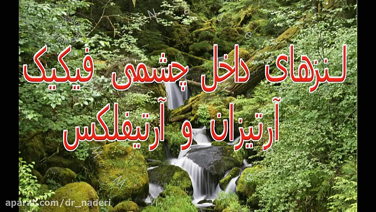 جراحی کارگذاری لنز آرتیزان و آرتیفلکس-مرکز چشم پزشکی دکتر علیرضا نادری مرکز چشم پزشکی دکتر علیرضا نادری www.dr-naderi.com