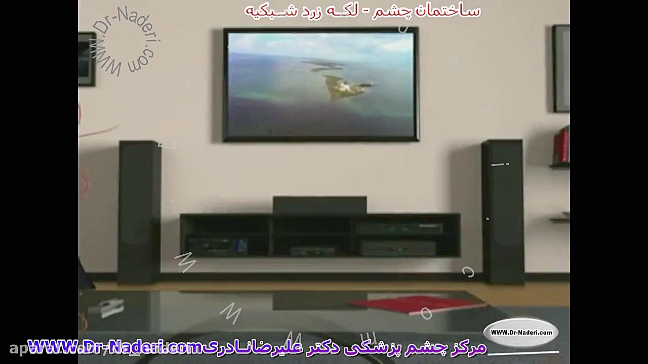لکه زرد شبکیه چشم یا ماکولا - مرکز چشم پزشکی دکتر علیرضا نادری مرکز چشم پزشکی دکتر علیرضا نادری www.dr-naderi.com