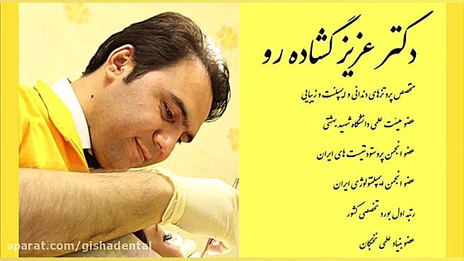 ایمپلنت فوری یکروزه توسط متخصص ایمپلنت در کلینیک گیشا کلینیک دندانپزشکی دکتر عزیز گشاده رو