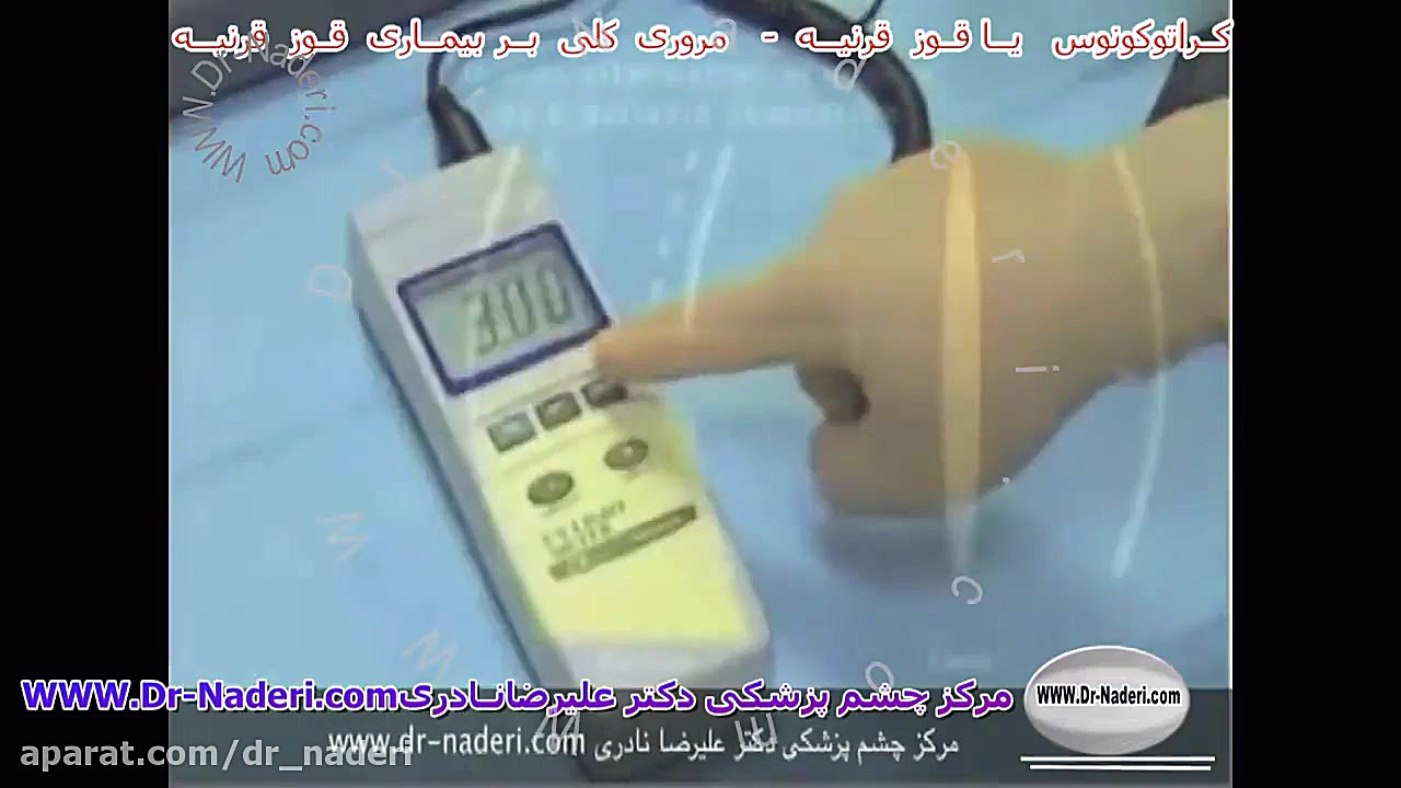 مروری کلی بر قوز قرنیه - مرکز چشم پزشکی دکتر علیرضا نادری مرکز چشم پزشکی دکتر علیرضا نادری www.dr-naderi.com