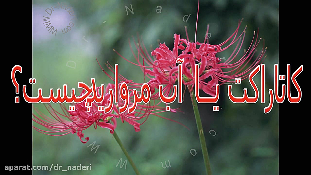 کاتاراکت یا آب مروارید چیست؟ مرکز چشم پزشکی دکتر علیرضا نادری مرکز چشم پزشکی دکتر علیرضا نادری www.dr-naderi.com