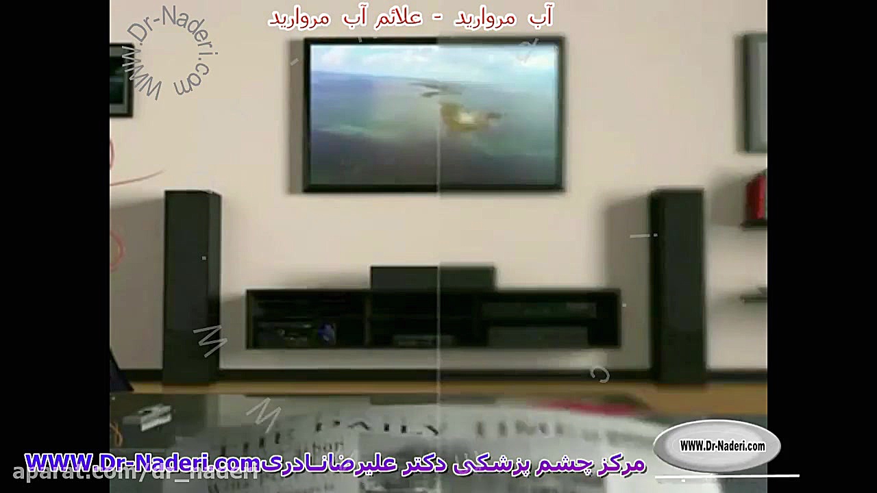 علائم آب مروارید - مرکز چشم پزشکی دکتر علیرضا نادری مرکز چشم پزشکی دکتر علیرضا نادری www.dr-naderi.com