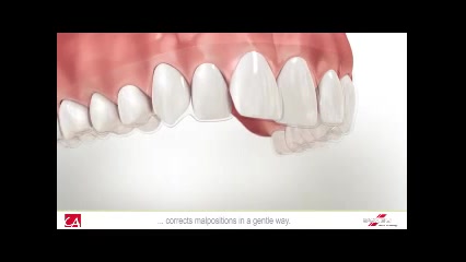 مراحل ساخت clear aligner دکتر سهیل سالاری